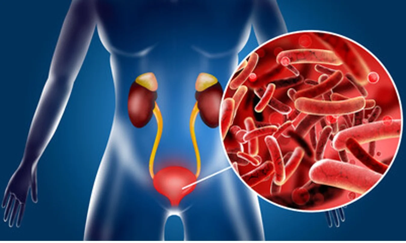 Image-depicting-how-Urinary-Tract-Infections-look-within-the-body-and-where-theyre-located